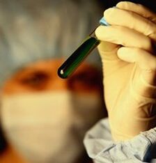 паразиттерге кантип текшерүү керек